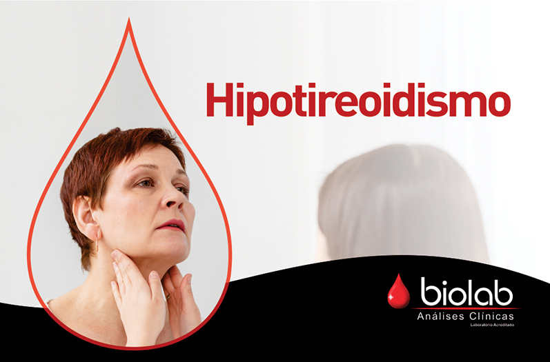 A importância do exame TSH - Hipotireoidismo